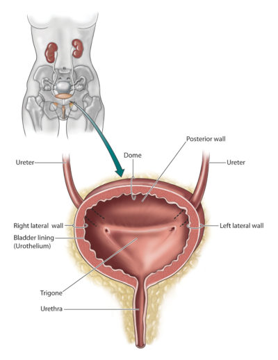 Illustrations - Bladder Cancer